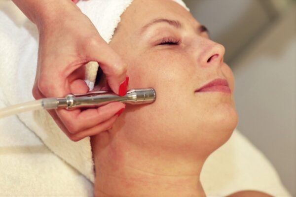 Diamantová dermabraze