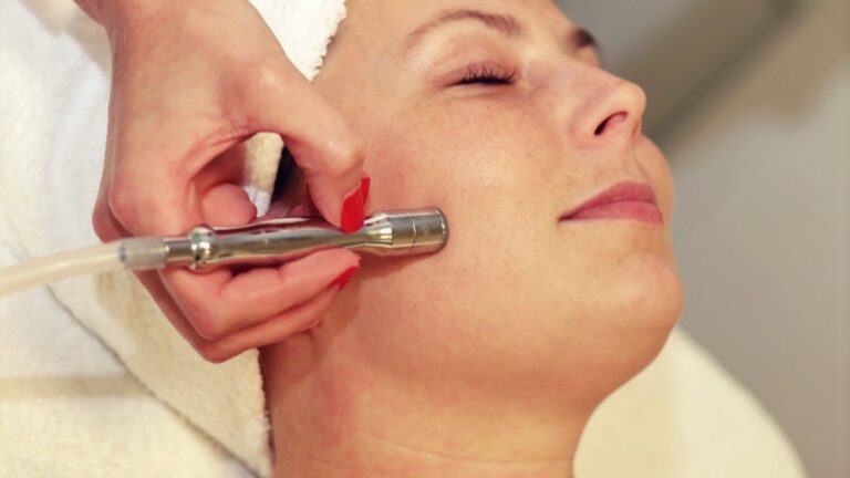 Diamantova dermabraze
