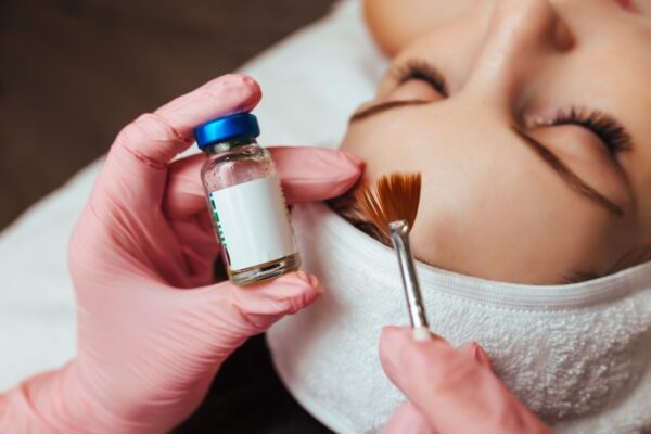 Chemický peeling (Larens Professional)